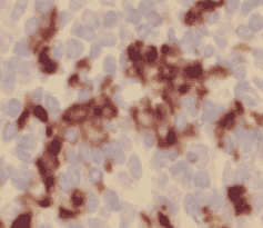 Anti-WDFY4 antibody - Click Image to Close