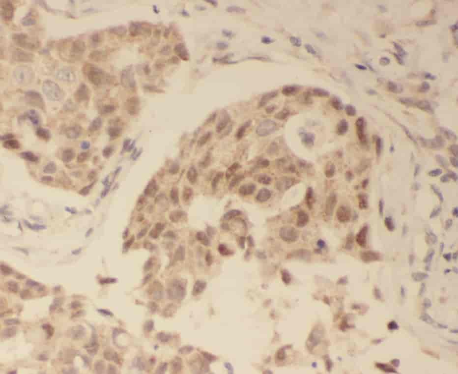Anti-WDR61 antibody - Click Image to Close