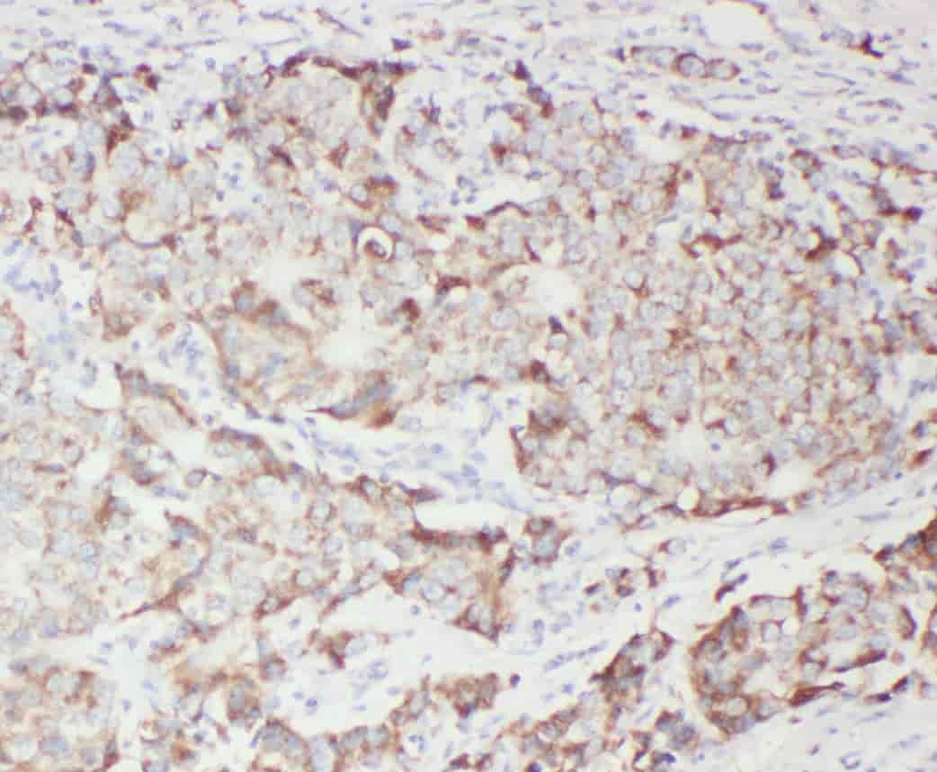 Anti-WFDC1 antibody - Click Image to Close