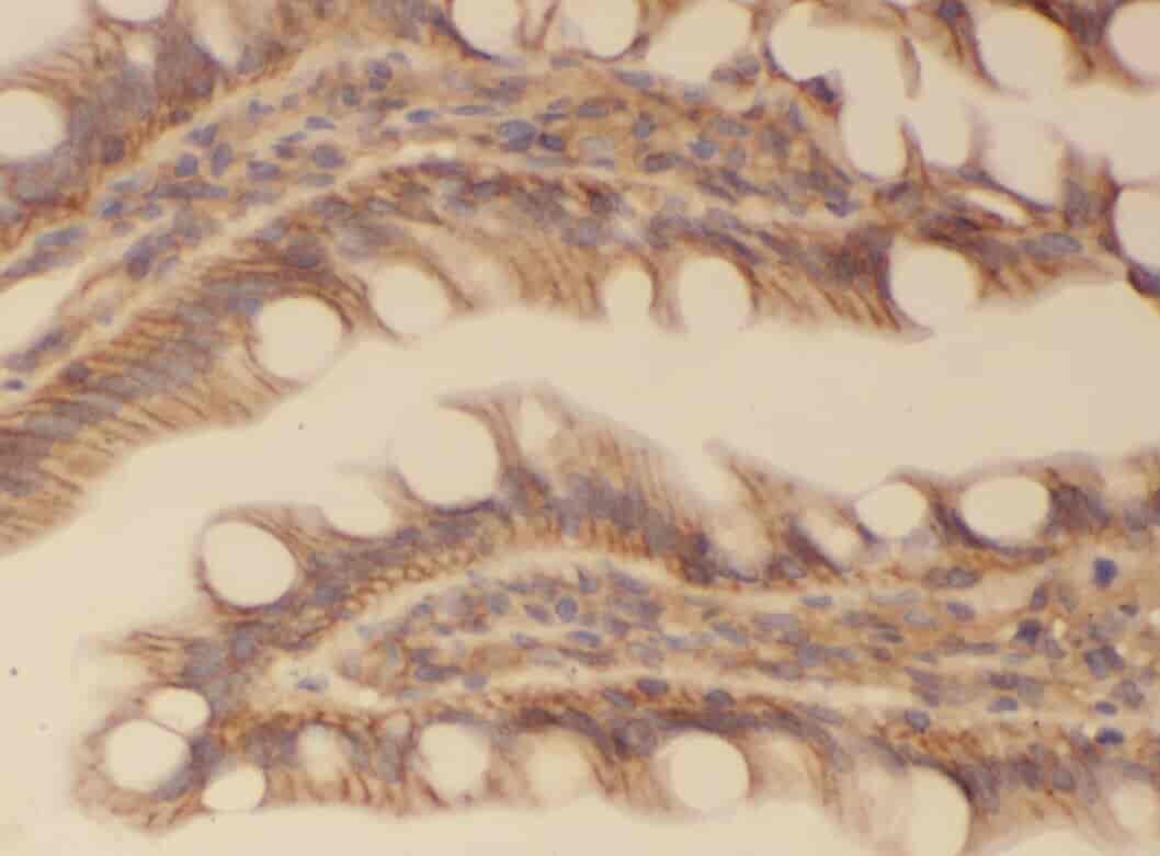 Anti-WNT6 antibody - Click Image to Close