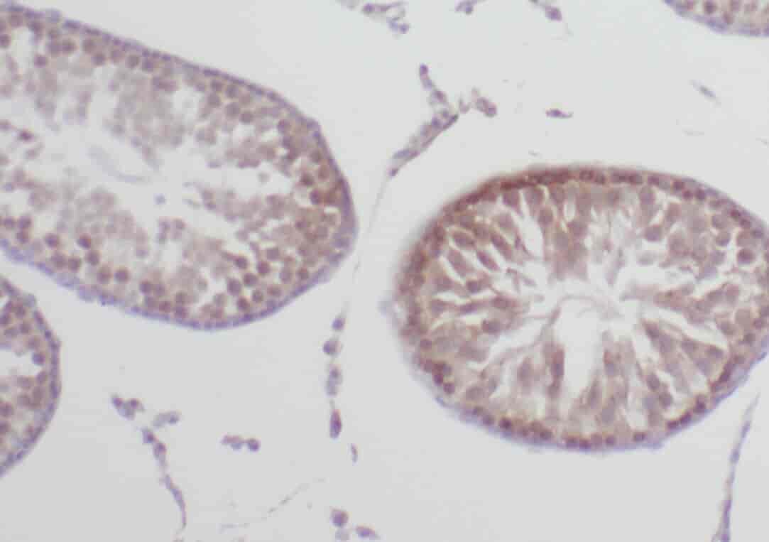 Anti-WRAP53 antibody - Click Image to Close