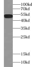 Anti-WT1 antibody - Click Image to Close