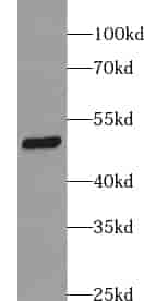 Anti-WWOX antibody - Click Image to Close