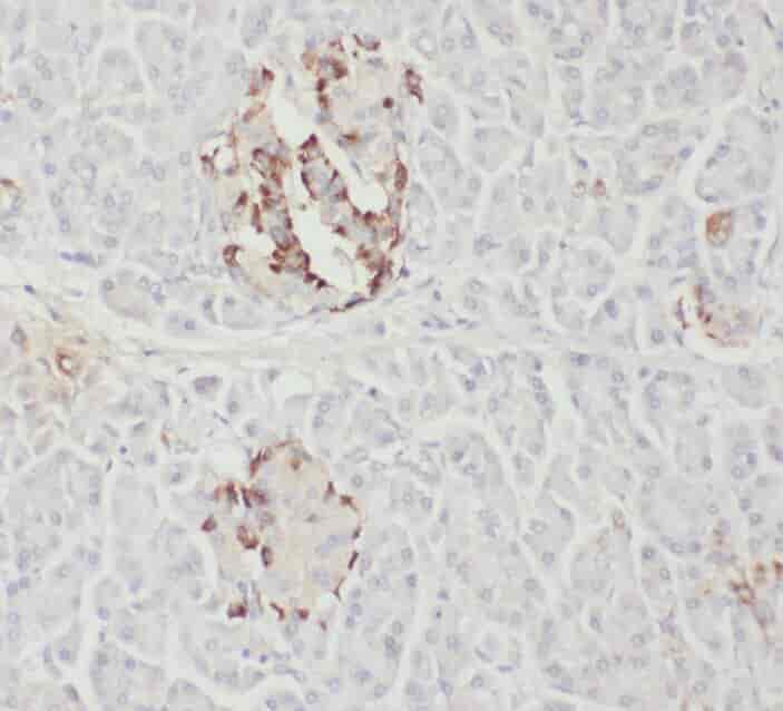 Anti-WWP2 antibody - Click Image to Close