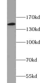 Anti-XDH antibody - Click Image to Close