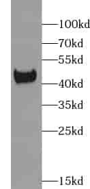 Anti-XKR6 antibody