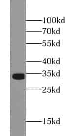 Anti-XLF antibody