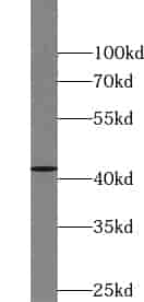 Anti-XPA antibody - Click Image to Close