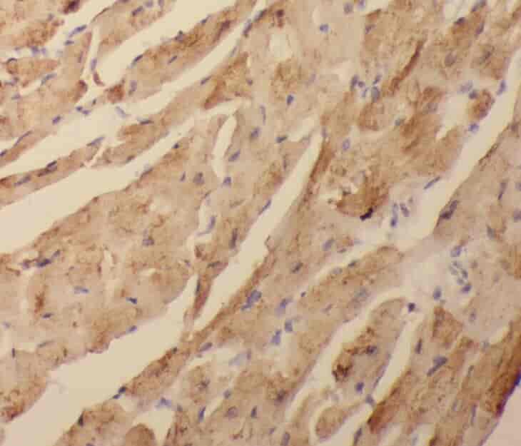 Anti-XPR1 antibody - Click Image to Close
