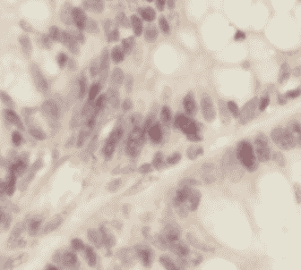Anti-XRCC5/Ku80 antibody - Click Image to Close