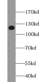 Anti-XYLT1 antibody - Click Image to Close