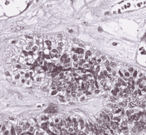 Anti-YAP1 antibody - Click Image to Close