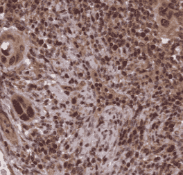 Anti-YEATS2 antibody - Click Image to Close