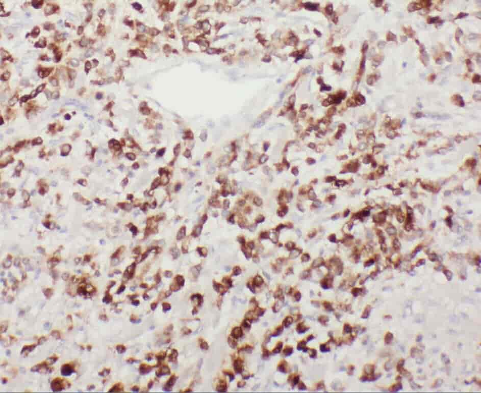 Anti-YIPF4 antibody - Click Image to Close