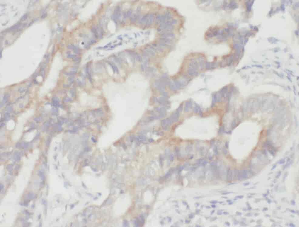 Anti-YME1L1 antibody - Click Image to Close