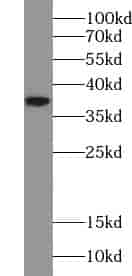 Anti-YOD1 antibody - Click Image to Close