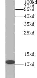 Anti-YPEL3 antibody - Click Image to Close