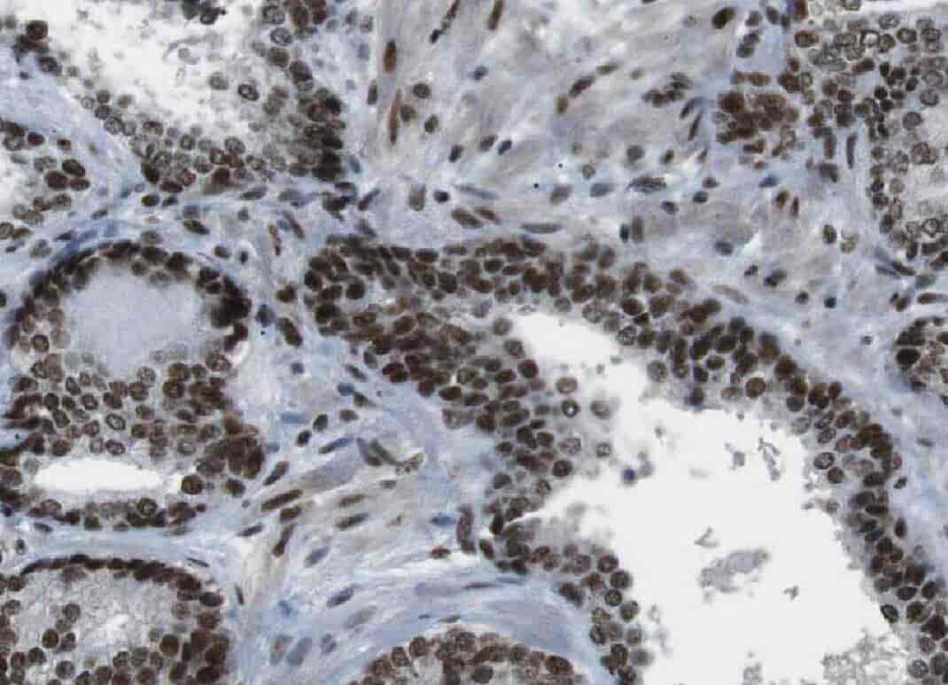 Anti-YPEL5 antibody - Click Image to Close