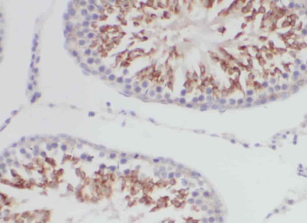 Anti-YTHDF2 antibody - Click Image to Close