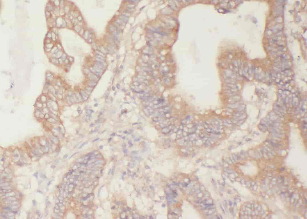 Anti-YWHAB antibody - Click Image to Close