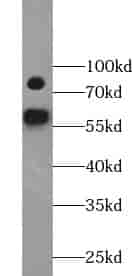 Anti-YY1AP1 antibody - Click Image to Close