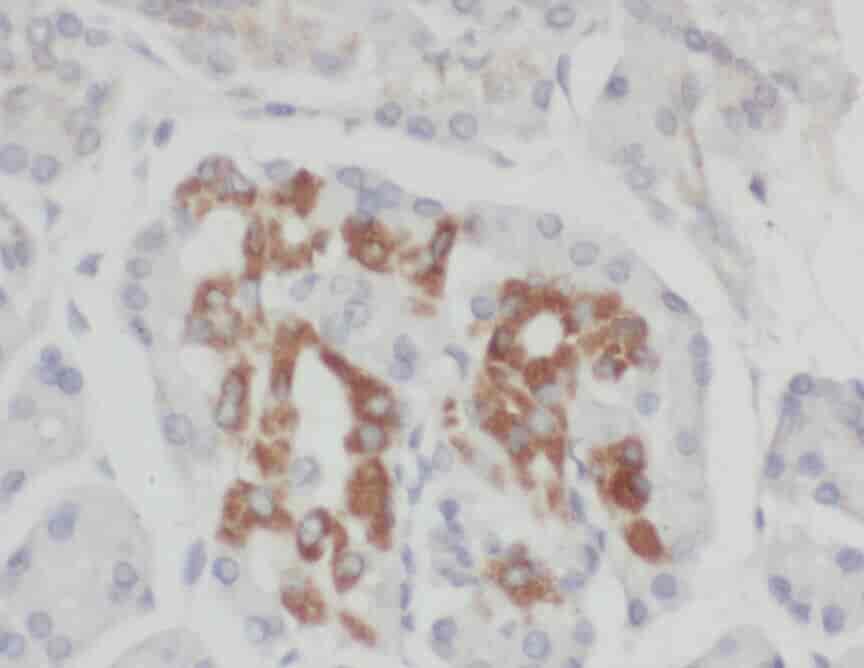 Anti-ZADH2 antibody - Click Image to Close