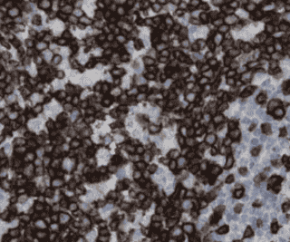 Anti-ZAP70 antibody - Click Image to Close