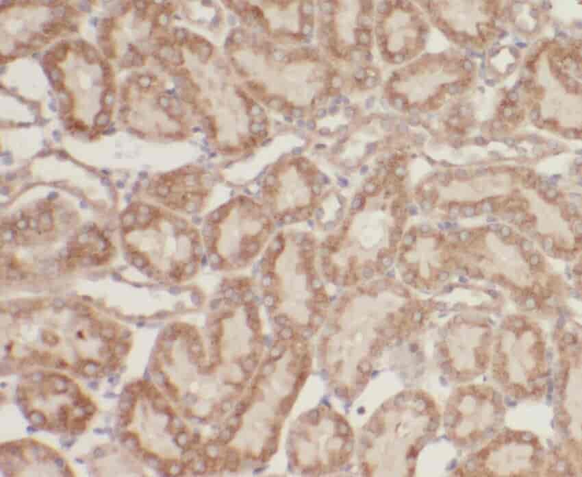 Anti-ZBTB20 antibody - Click Image to Close