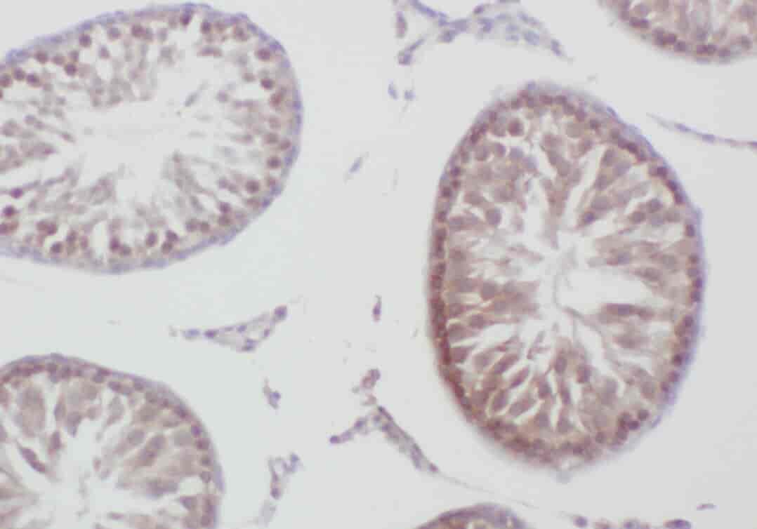 Anti-ZBTB38 antibody - Click Image to Close