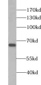 Anti-ZBTB46 antibody - Click Image to Close