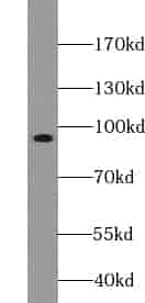 Anti-ZC3H11A antibody - Click Image to Close