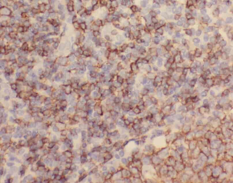 Anti-ZC3H12D antibody - Click Image to Close