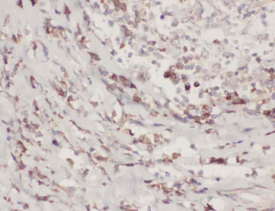 Anti-ZC3H4 antibody - Click Image to Close
