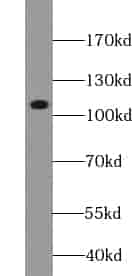 Anti-ZC3H7B antibody - Click Image to Close