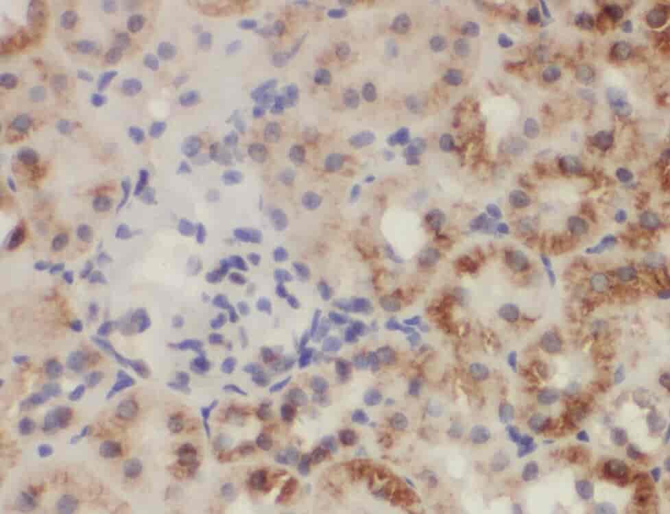 Anti-ZC3HAV1L antibody - Click Image to Close
