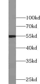 Anti-ZC3HC1 antibody