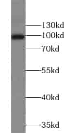 Anti-ZCCHC8 antibody - Click Image to Close