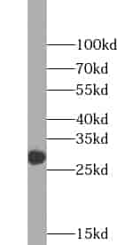 Anti-ZCRB1 antibody - Click Image to Close