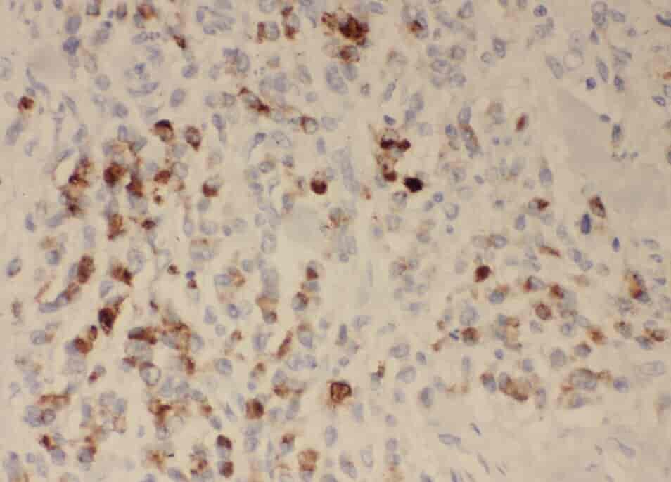 Anti-ZDHHC13 antibody - Click Image to Close