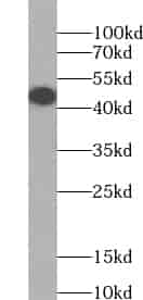 Anti-ZDHHC15 antibody - Click Image to Close