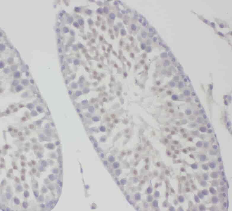 Anti-ZDHHC9 antibody - Click Image to Close
