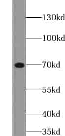 Anti-ZFP64 antibody - Click Image to Close