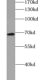Anti-ZFP90 antibody - Click Image to Close