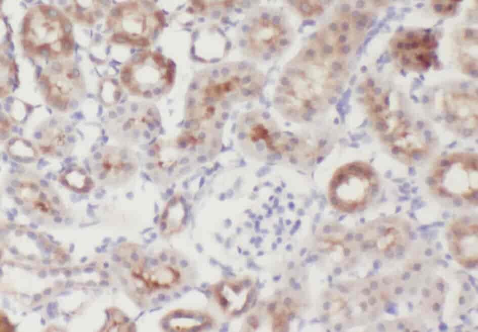 Anti-ZFYVE16 antibody - Click Image to Close