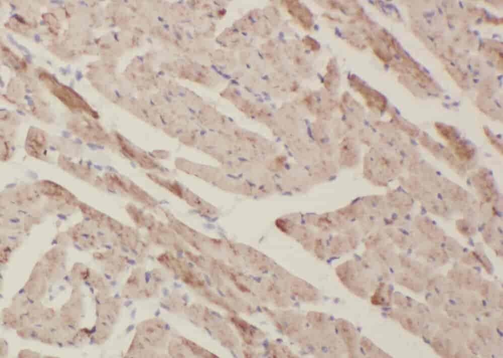 Anti-ZFYVE19 antibody - Click Image to Close