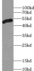 Anti-ZFYVE27 antibody - Click Image to Close