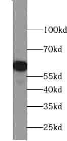 Anti-ZGPAT antibody - Click Image to Close