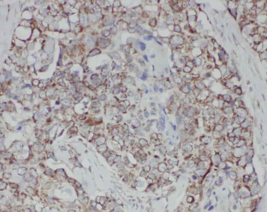 Anti-ZHX1 antibody - Click Image to Close