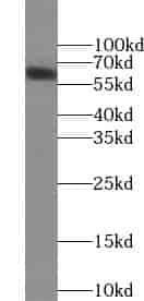 Anti-ZIM3 antibody - Click Image to Close