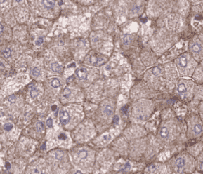 Anti-ZIP4 antibody - Click Image to Close
